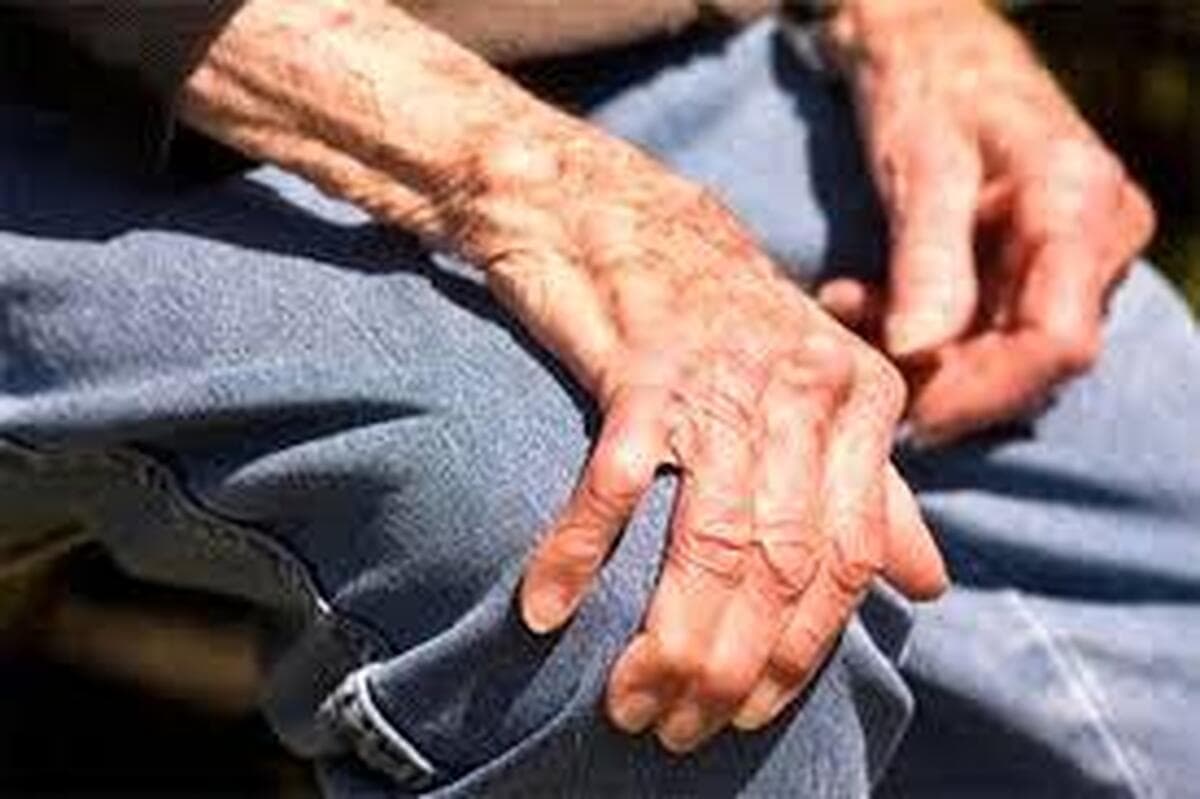 چگونه روند پارکینسون کند می‌شود؟