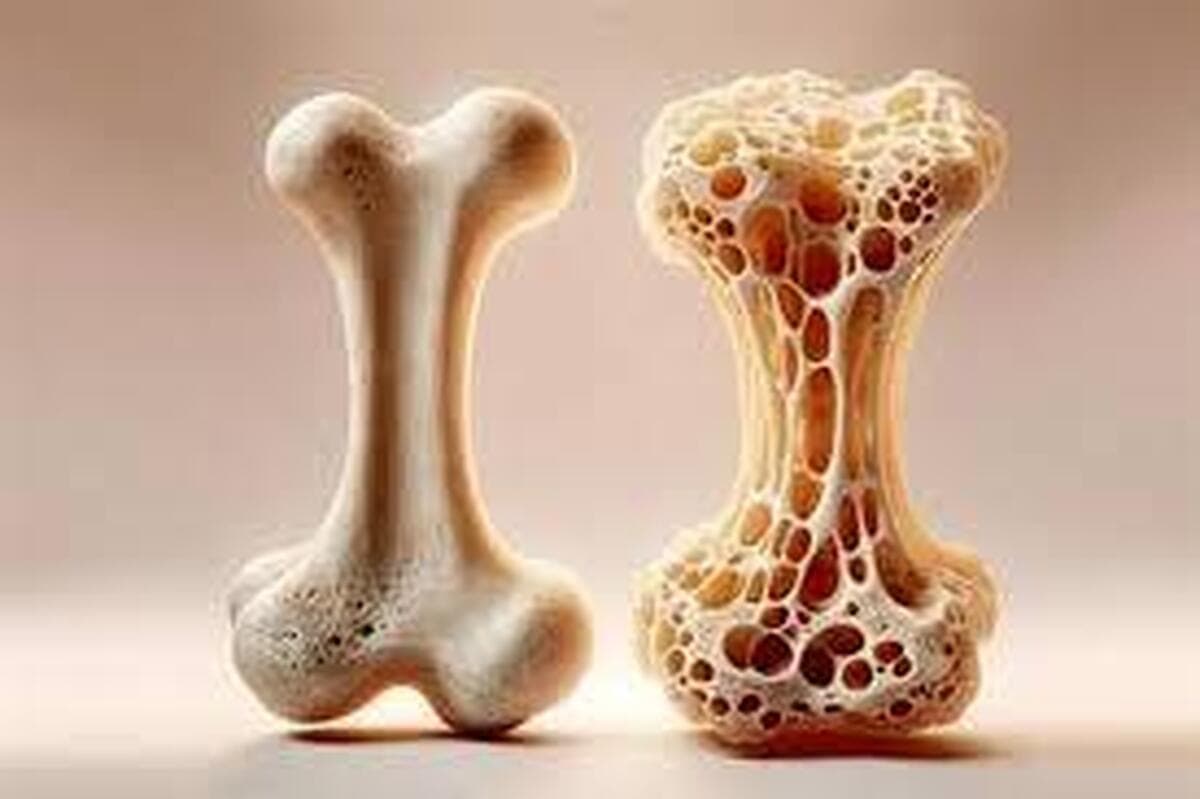 با این ماده معدنی مانع پوکی استخوان شوید