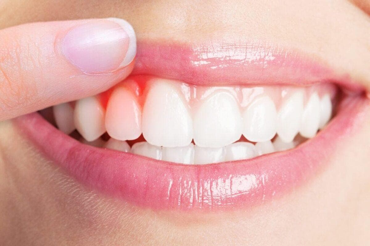 چطور بفهمیم علت بوی بد دهان ما از کجاست و چگونه آن را برطرف کنیم؟
