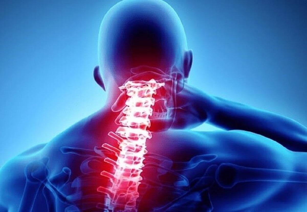 خار استخوان گردن چیست؟ نشانه‌ها و روش‌های درمان