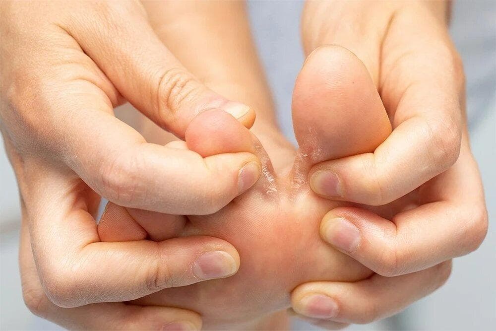 بین انگشتان پای شما چه می گذرد؟ | جوراب ها چه طور باید شسته شود؟
