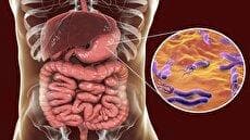 باکتری دشمن معده را بشناسید! (فیلم)
