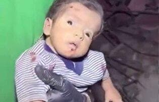شوک و حیرت در چشمان نوزاد فلسطینیِ نجات‌یافته از زیر آوار خانه ویران‌شده