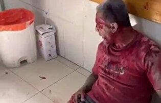 حاتم عمر، عکاس رویترز در این حمله شدیدا از ناحیه سر زخمی شده است
