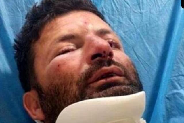 جزییات حمله 3 متخلف به محیط‌بان در شمال تهران