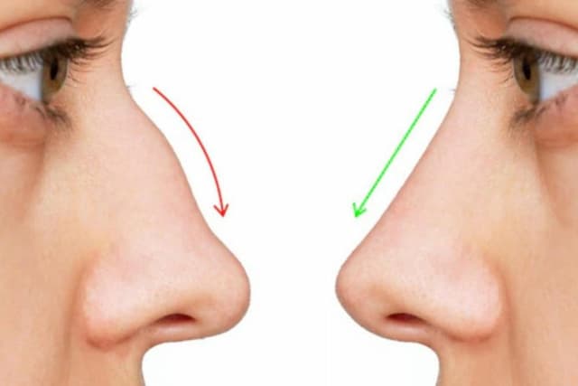 کدام پزشکان صلاحیت فعالیت در حوزه «زیبایی» را دارند؟