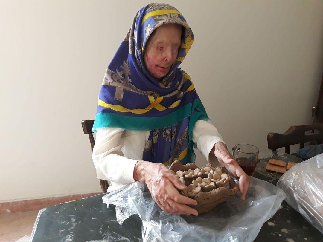 حکم سارق اسیدپاش در استان مرکزی صادر شد