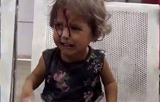 صحنه‌های دردناک از درمان کودکان زخمی در اردوگاه الشاطی غزه