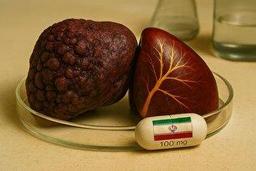 تولید بومی داروی «نینتدانیب» به بیماران فیبروز ریوی، امید دوباره برای زندگی می‌دهد