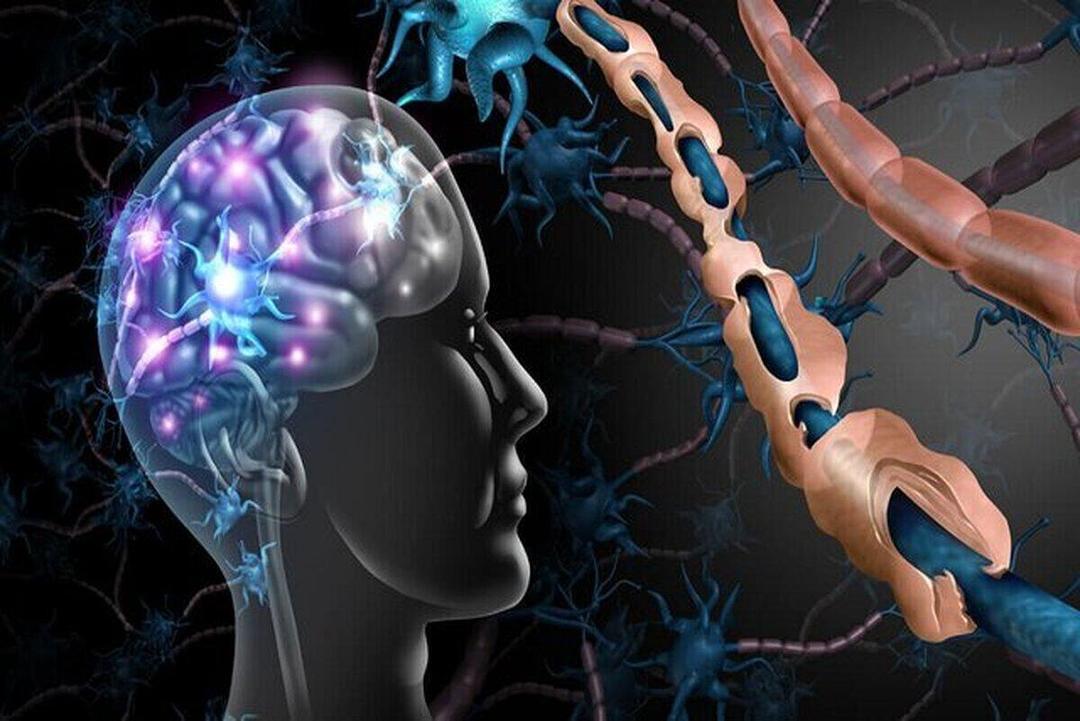 آلزایمر با اصلاح سبک زندگی قابل پیشگیری است