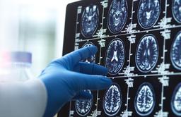 ذخیرهسازی خاطرات مصنوعی برای بیماران آلزایمر در امارات