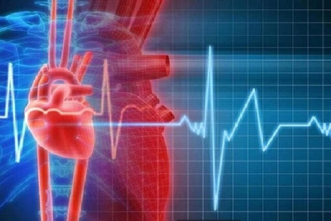 همه حمله‌های قلبی به گرفتگی رگ‌ها مربوط نیست!