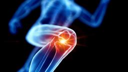 تاثیر عجیب میکروپلاستیکها بر استحکام استخوانها