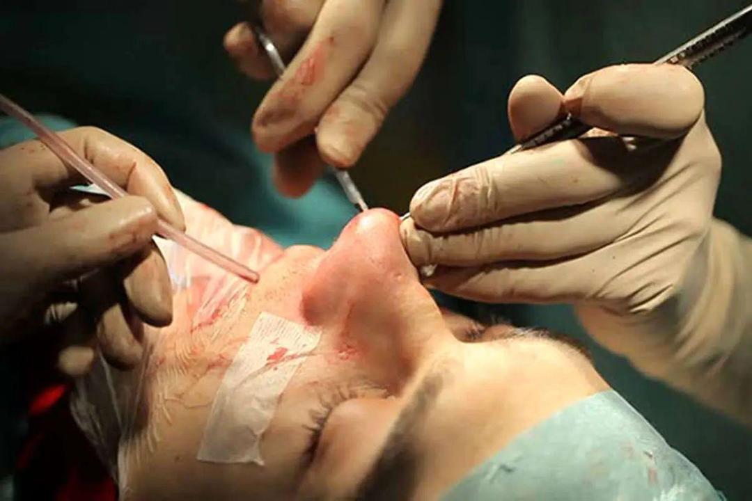 جزئیات قتل دختر جوان توسط جراح زیبایی قلابی