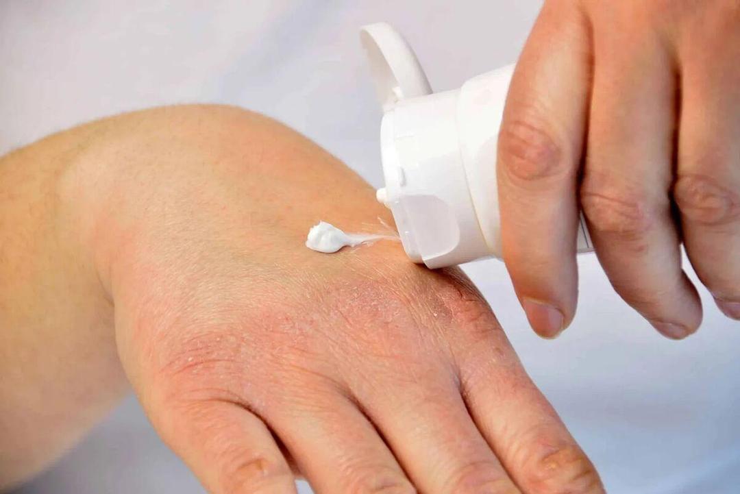 چگونه از خشکی پوست در پاییز جلوگیری کنیم؟