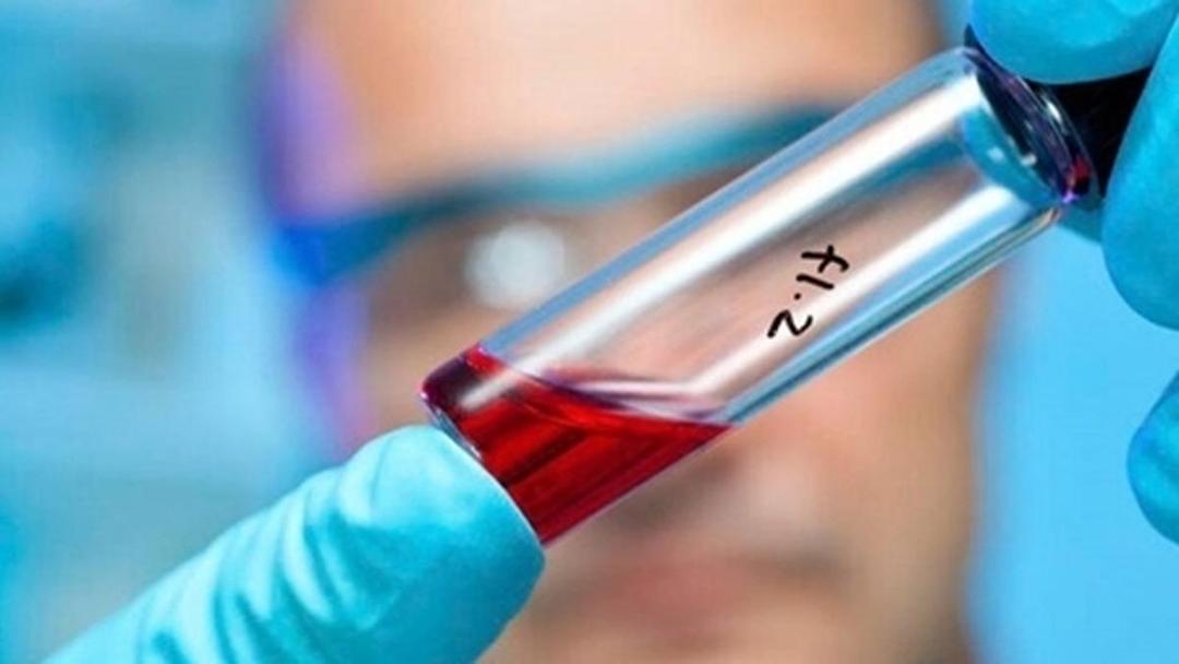 تأکید بر غربالگری و تشخیص زودهنگام در سرطان‌های سر و گردن