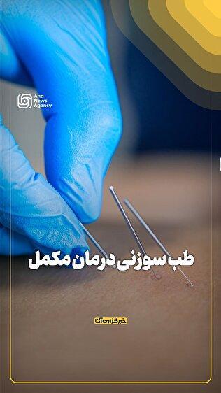 طب سوزنی درمان مکمل