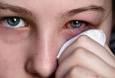 چرا چشم‌ها در پاییز حساس‌تر می‌شوند؟؛ بررسی دلایل و راهکارها
