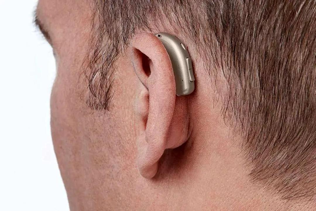 ۵.۵میلیون ایرانی دچار درجاتی از کم شنوایی هستند/ عوامل خطر کم شنوایی چیست؟