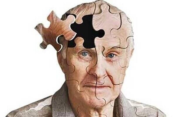 ارتباط آلودگی هوا با آلزایمر