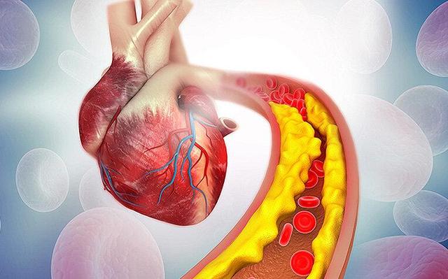 طلای مایع برای کاهش کلسترول