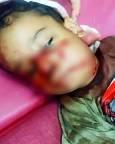 حادثه دلخراش در شوش / سگ مهاجم جان کودک ۴ ساله را تهدید کرد!