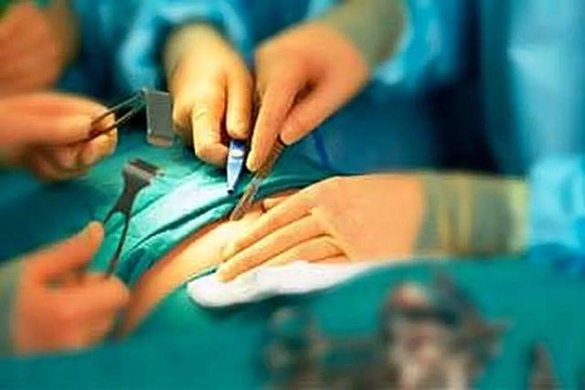 هشدار درباره پیکرتراشی در مراکز غیرمجاز + ویدئو