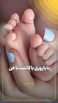 ناباروری با کاشت ناخن