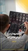 سکته زودتر سراغ ایرانی‌ها می‌آید