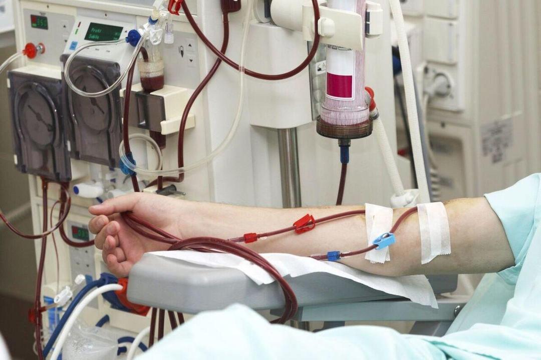بیمه‌ها مطالبات مراکز دیالیز غیردولتی در خراسان رضوی را با تاخیر طولانی پرداخت می‌کنند