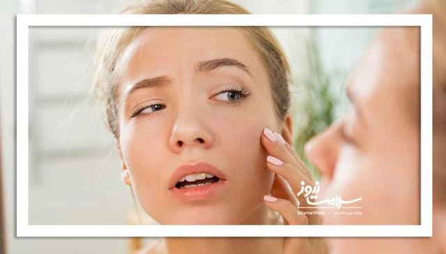 چرا گاهی صورت افراد ورم می‌کند؟