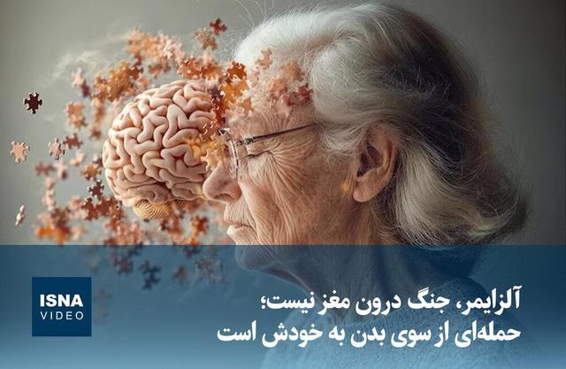 ویدیو/ آلزایمر، جنگ درون مغز نیست؛ حمله‌ای از سوی بدن به خودش است