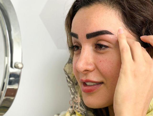 کاشت ابرو طبیعی؛ بازگرداندن زیبایی و اعتمادبه‌نفس با علم روز