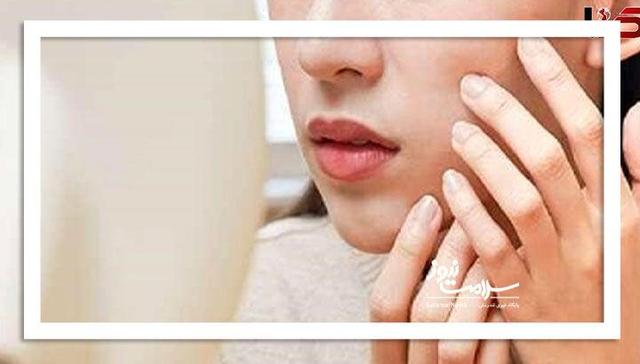 کلاژن؛ معجزه جوانی یا بازی تبلیغاتی؟