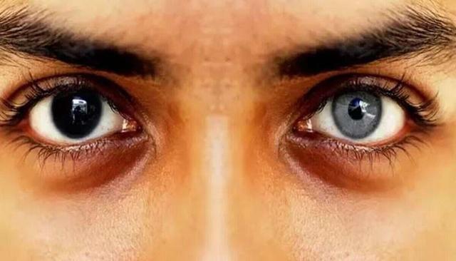 انجام این عمل جراحی ممنوع شد + ویدئو | عوارض خطرناک تتوی قرنیه چیست؟