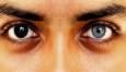 انجام این عمل جراحی ممنوع شد + ویدئو | عوارض خطرناک تتوی قرنیه چیست؟