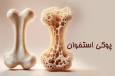 این افراد در خطر پوکی استخوان اند!