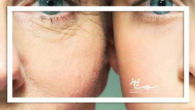 چرا برخی پیرتر از سن واقعی خود نشان می‌دهند؟