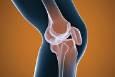 پرتودرمانی به تسکین درد آرتروز زانو کمک می کند؟
