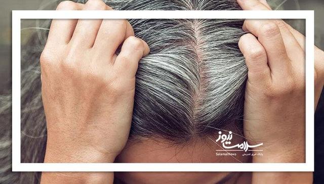 آیا سفیدی مو همیشگی است؟