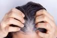 یافته‌ای جدید درباره سفید شدن مو