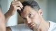 طرز فکر اشتباهی که برای درمان ریزش مو وجود دارد + فیلم