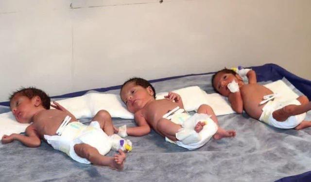 ثبت بیش از ۱۱ هزار واقعه ولادت چند قلوزایی طی امسال