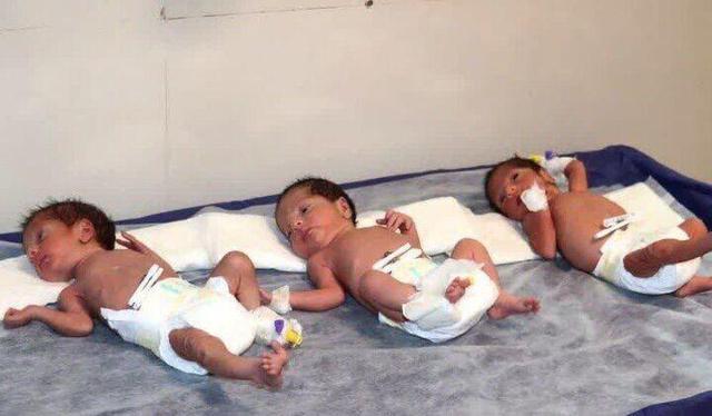 ثبت بیش از ۱۱ هزار واقعه ولادت چند قلوزایی طی امسال