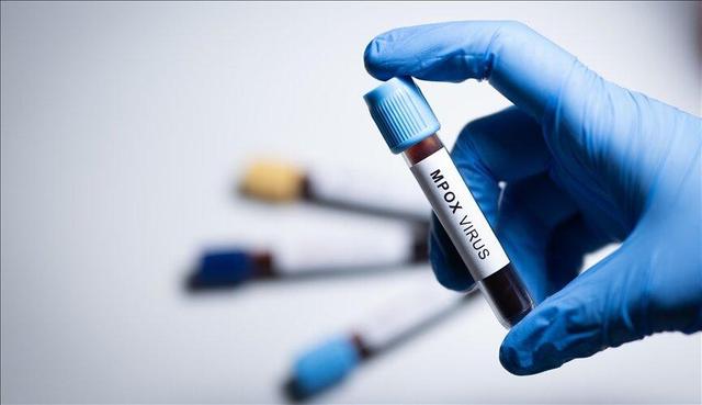 سازمان جهانی بهداشت: «ام پاکس» در کشورهای بیشتری شناسایی شده است