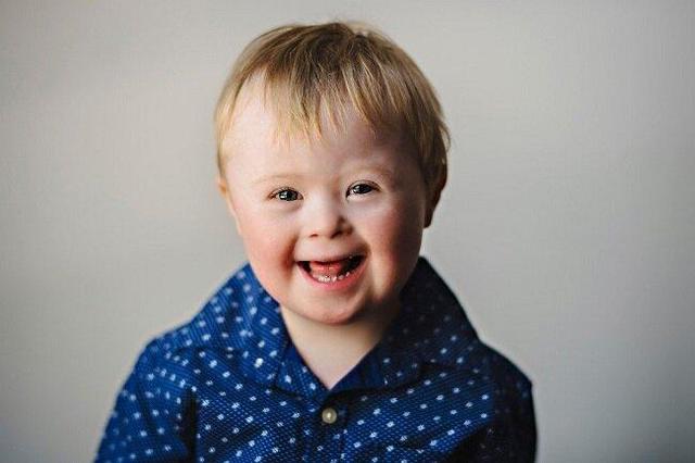 ببینید | ثبت لحظه شادی وصف‌ناپذیر کودک مبتلا به سندرم داون به خاطر دیدن دوست صمیمی‌اش