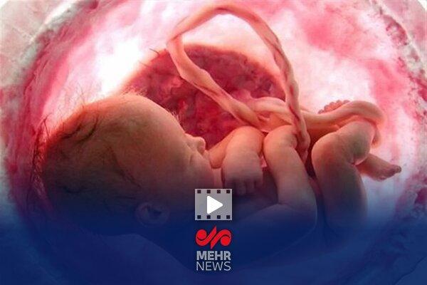 کاهش چشمگیر آمار سقط جنین در کشور با اجرای طرح «نفس»
