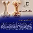بیماری پوکی استخوان را بیشتر بشناسیم
