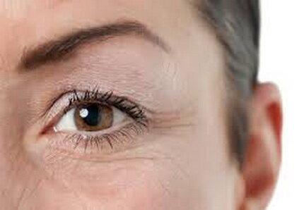 ۶ خوردنی که شما را زودتر پیر می‌کنند