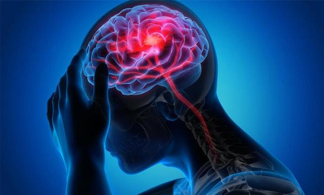 سکته مغزی در ایران دومین علت مرگ‌ومیر است